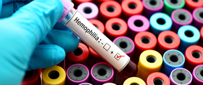هل مرض الهيموفيليا خطير